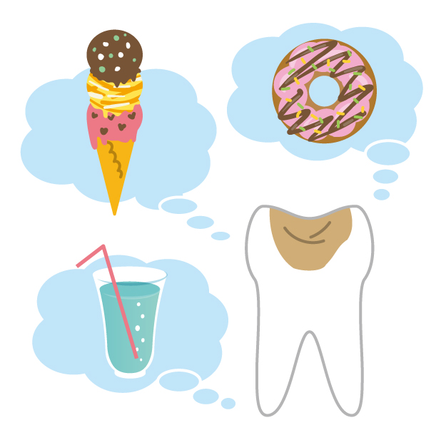 虫歯の原因について