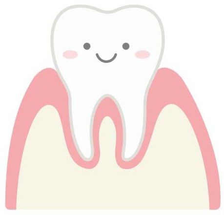 歯肉炎（初期段階）