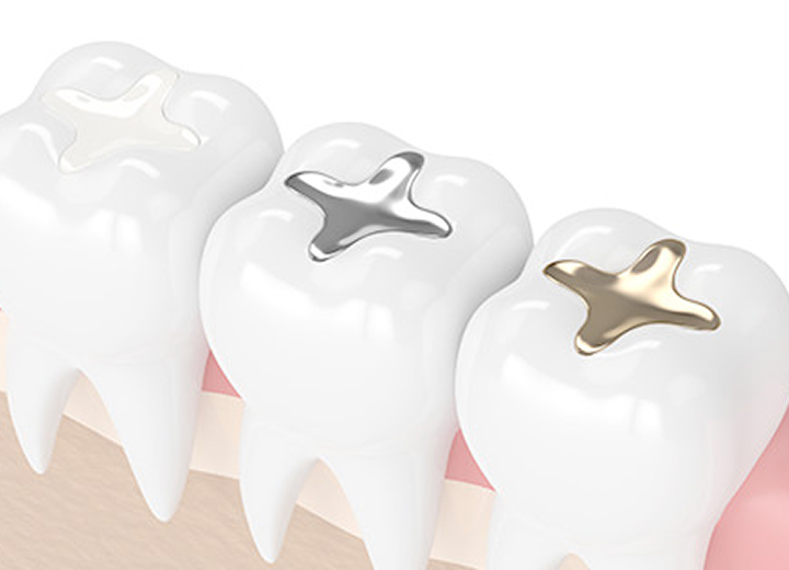 セラミック治療