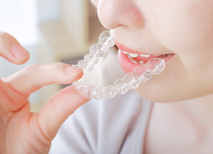 マウスピース製作